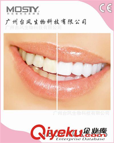 台式牙齿美白仪广州美博城美容牙科专业选择的设备15920909077